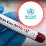 Congo Ebola Outbreak 2026